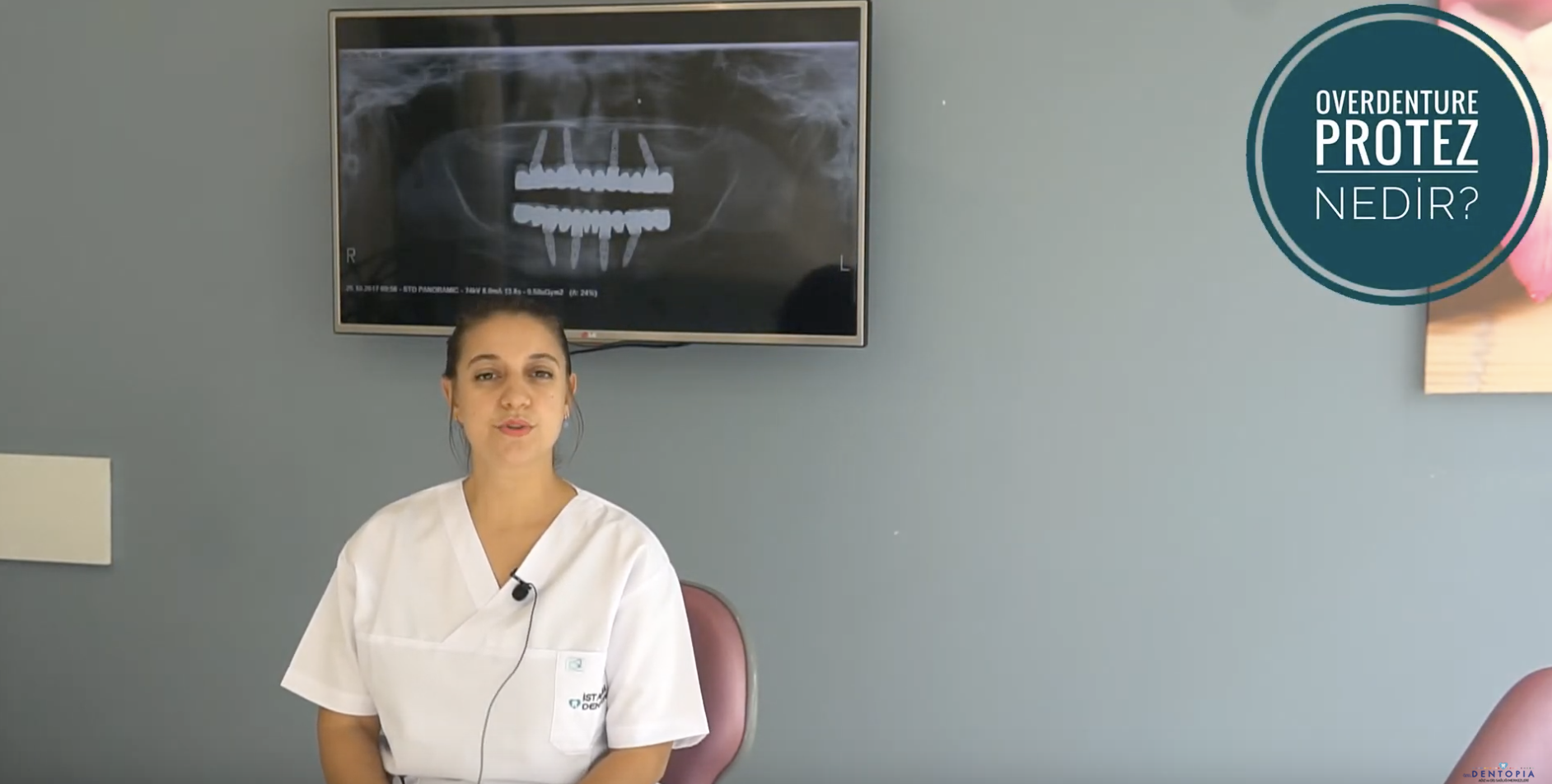 İmplant destekli overdenture protezler nedir ?