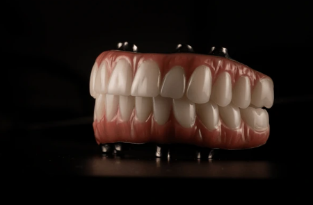 All On Four İmplant